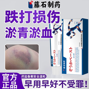 治疗跌打损伤专磕碰淤青淤血活血i化瘀膏儿童可用药房同款