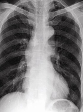 兼容适用Epn 1390喷墨打印机墨水 L801X光CT胶片染料墨水可加墨