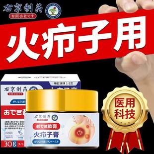 火疖子拔毒拔脓膏火疖子膏药拔毒拔脓膏治脓包硬块屁股上长痘痘