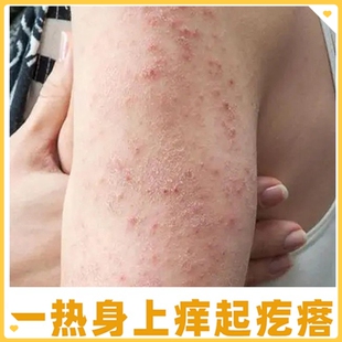 身体干痒专用膏换季小腿痒身上洗澡皮肤干燥起皮抑痒掉皮屑菌膏