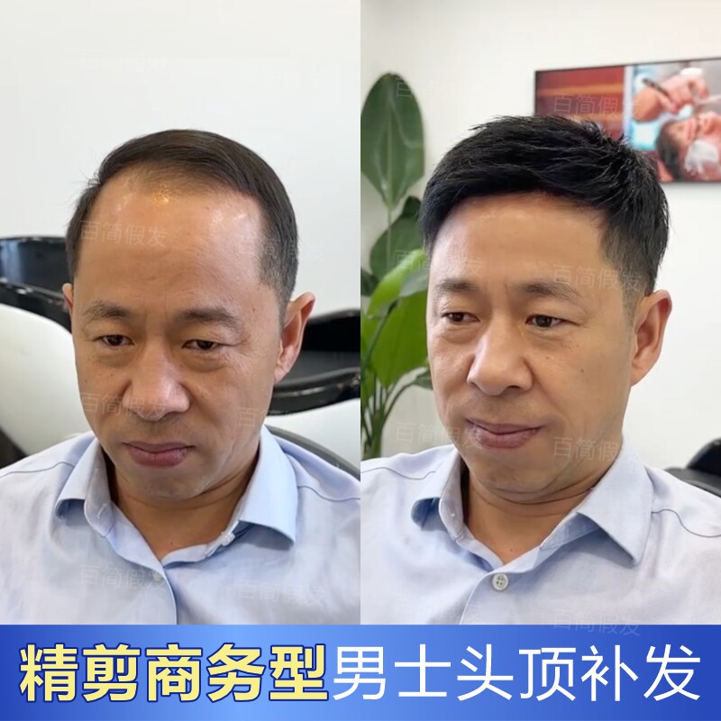 男士假发真发商务头顶补发块隐形无痕遮白发地中海秃头男士补发片