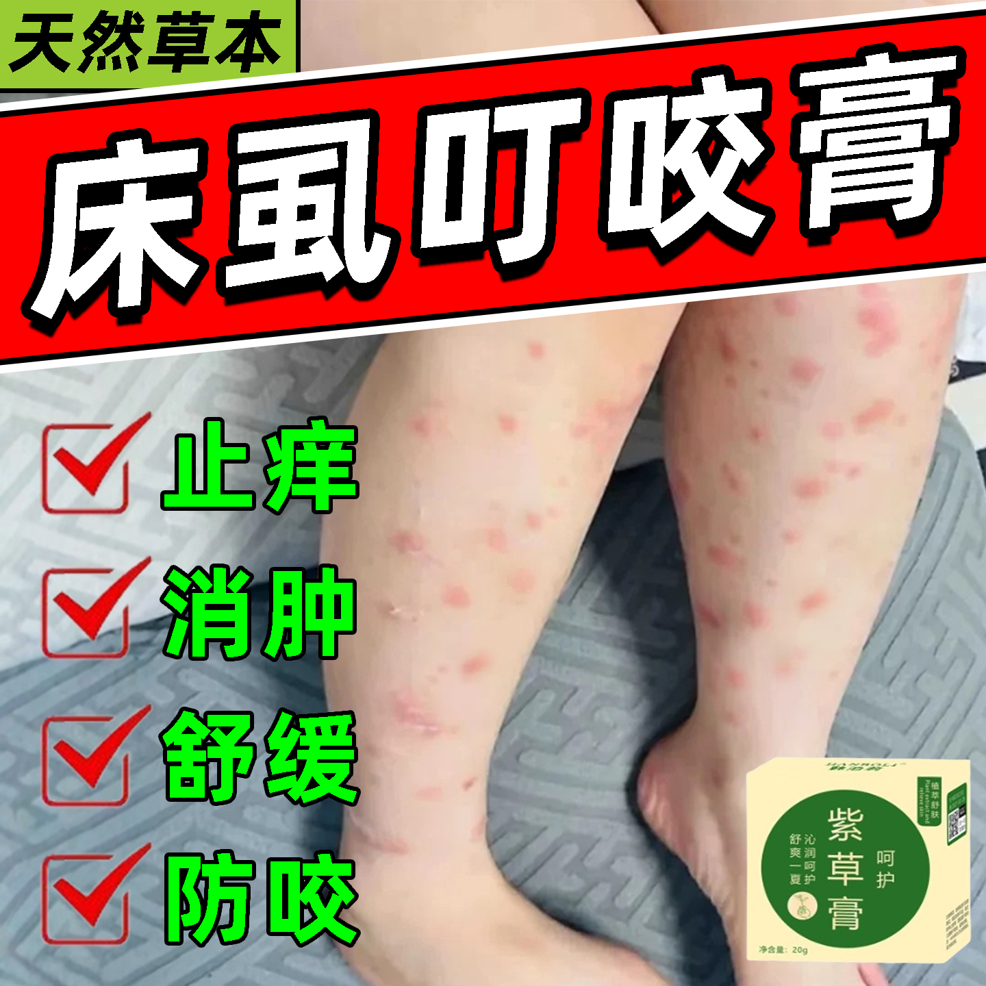 床虱叮咬药膏被咬了之后止痒消肿舒缓膏瘙炎专用青紫草膏跳蚤臭虫