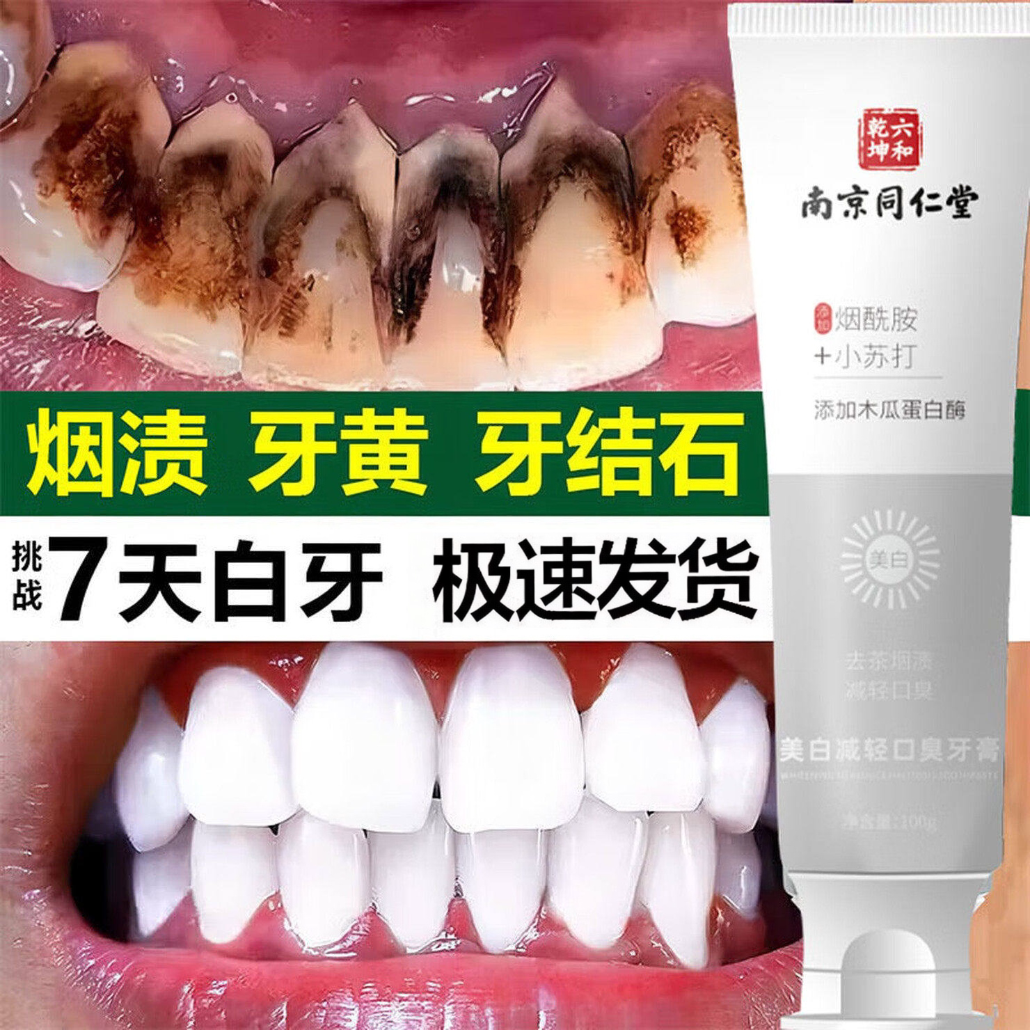 南京同仁堂牙膏美白去黄去口臭去茶渍烟渍牙垢清新口气防蛀牙正品