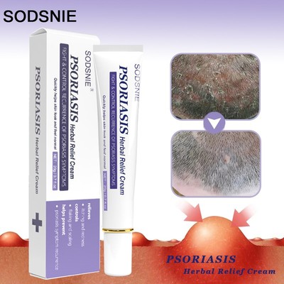 Psoriasis Herbal Relief Cream Nourish Anti-Fungal Treatment