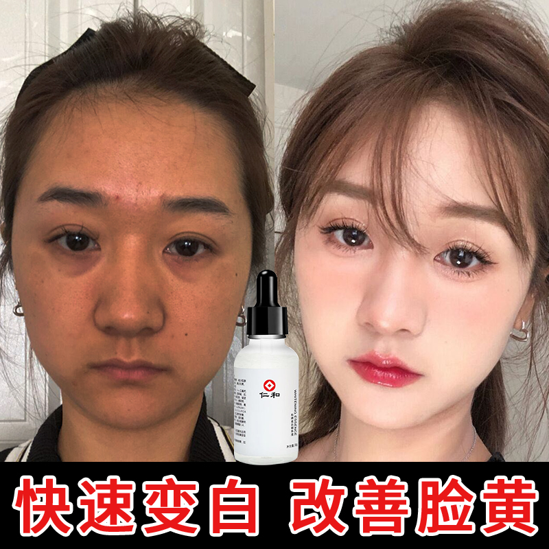 美白提亮去黄改善暗沉肤色气皮肤暗黄抗氧化祛斑精华液分解黑色素