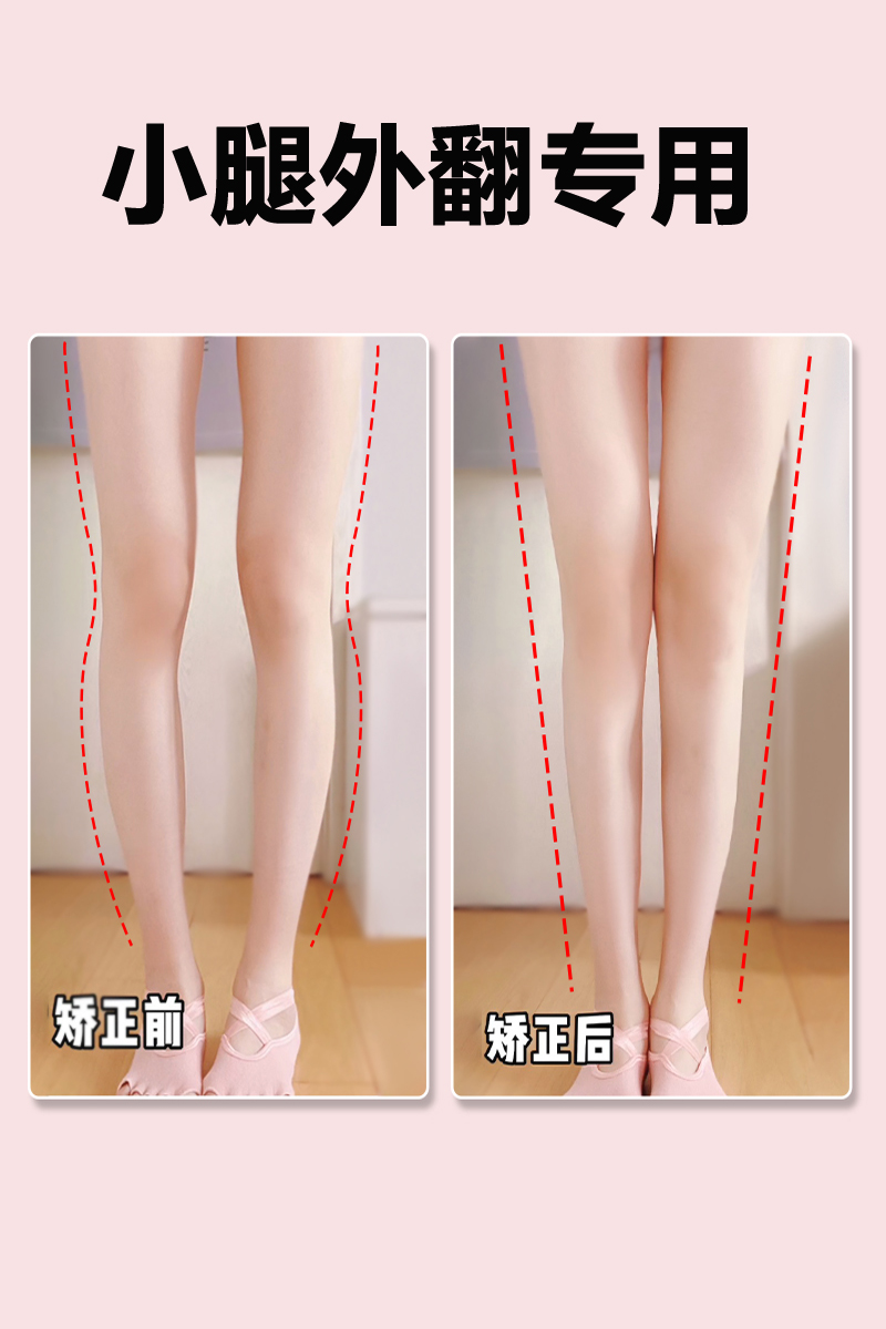 Xo型腿矫正鞋垫 价格 怎么样 图片 Xo型腿矫正鞋垫 价格 怎么样 图片