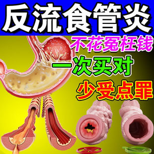 胃食管反流贴治胃反酸烧心反流性食道炎胆汁胃酸胃炎调理中药贴茶