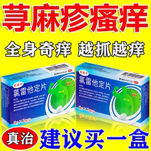 氯雷他定片治荨麻疹皮肤过敏皮肤瘙痒断特效根止痒的药抗过敏药WM