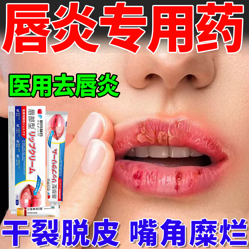 红霉素软膏唇炎专用药膏治疗嘴唇干裂脱皮儿童成人口角炎烂嘴角WQ