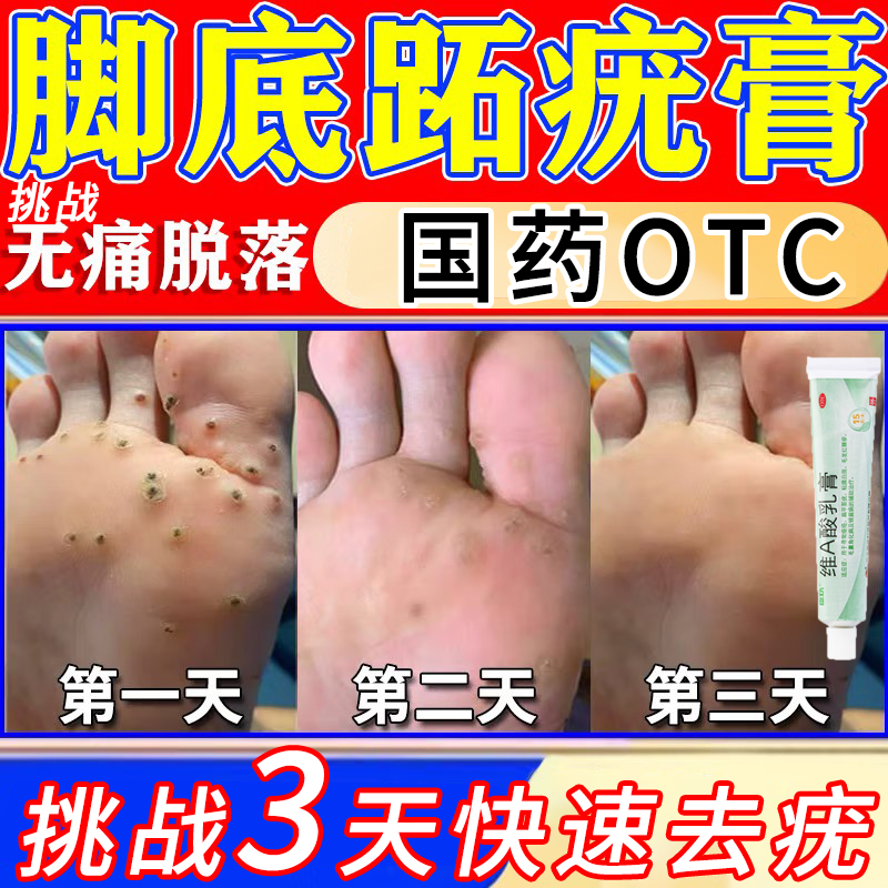 【臣功】维A酸乳膏0.025%*15g*1支/盒跖疣扁平疣痤疮银屑病祛痘祛痘印美白