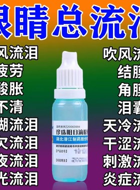 治迎风流泪眼药水消止痒杀菌眼睛炎干涩怕光流眼泪眼睛痒红肿胀痛