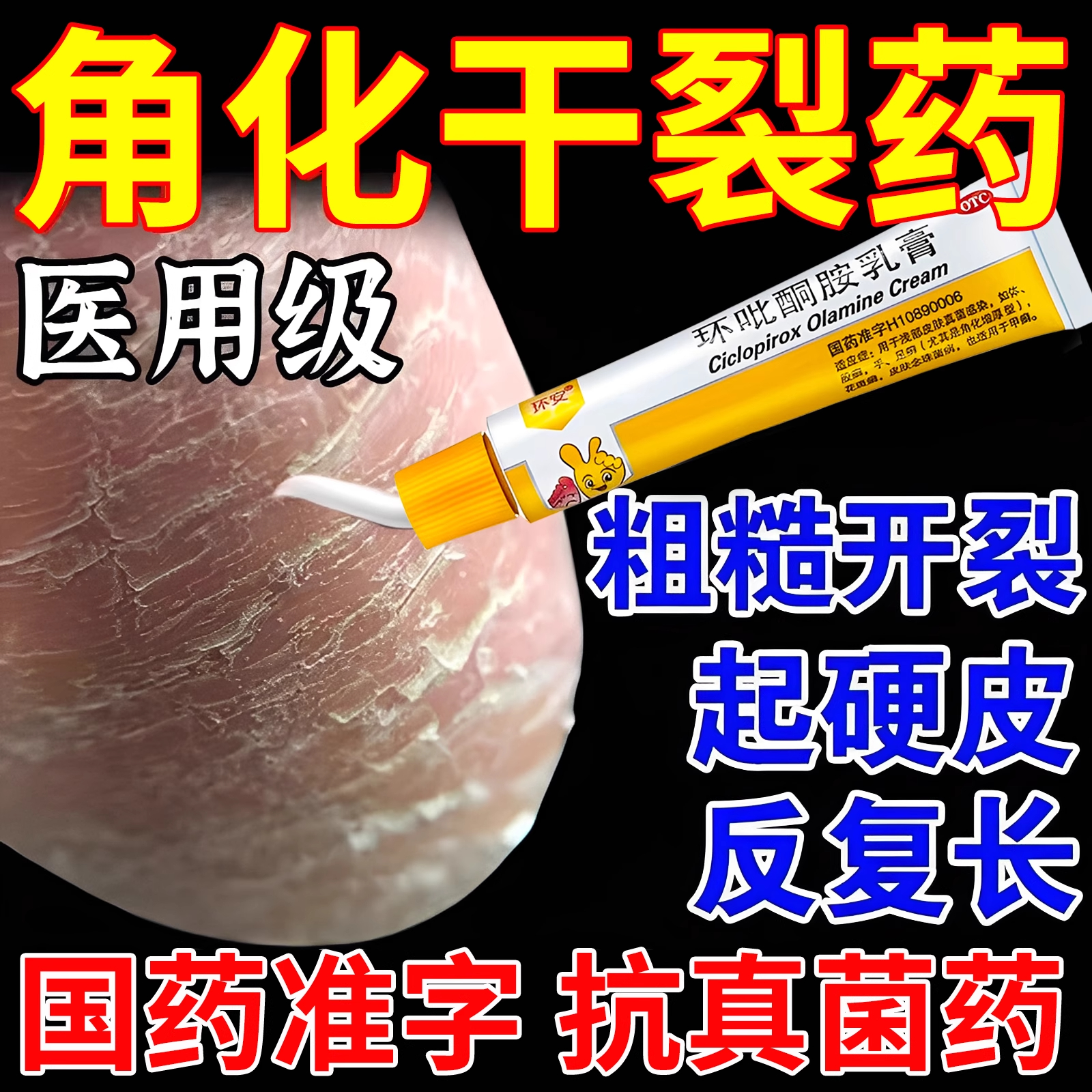 【金归】环吡酮胺乳膏1%*20g*1支/盒【角化型脚气专用药】