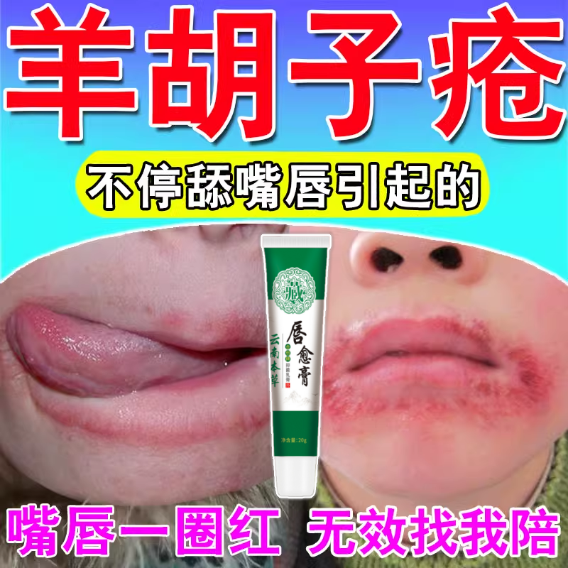 羊胡子疮小孩舔嘴巴干裂脱皮起泡软膏嘴唇口周炎上火烂嘴修复唇膏
