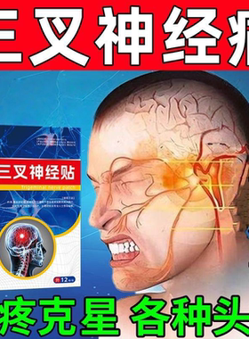 三叉神经药物面部疼痛贴膏顽固性偏头痛头晕三岔神经脸疼牙疼克星