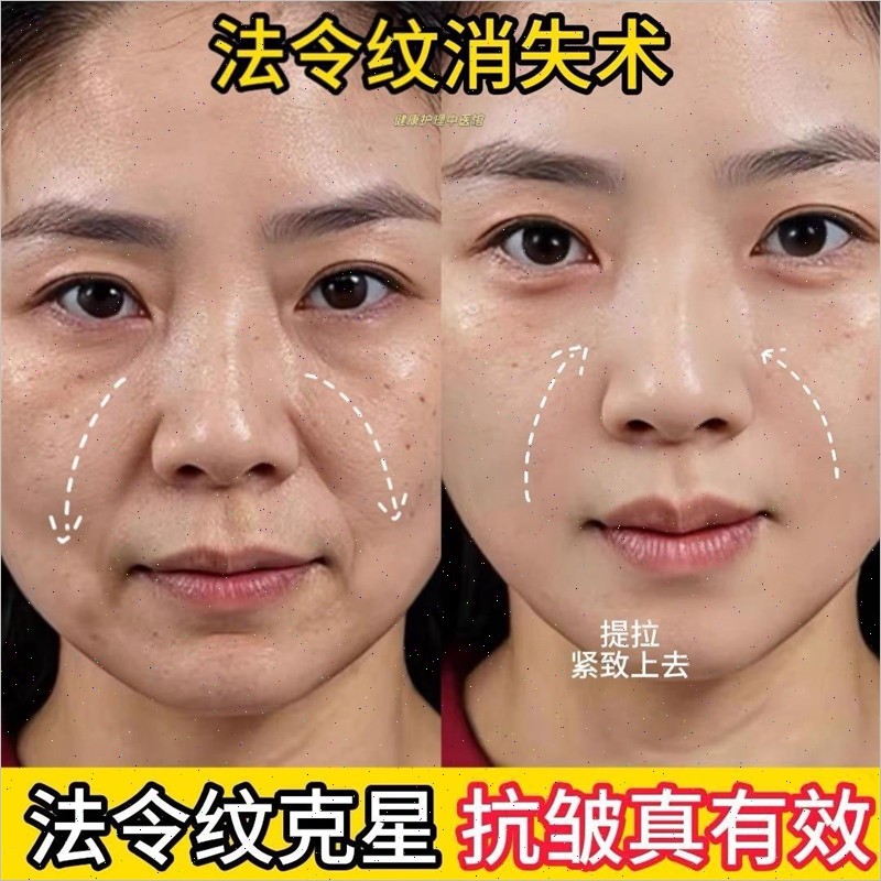 【屈臣氏爆卖】6D凝水微晶贴淡化法令纹嘴角纹提拉紧致非小工具