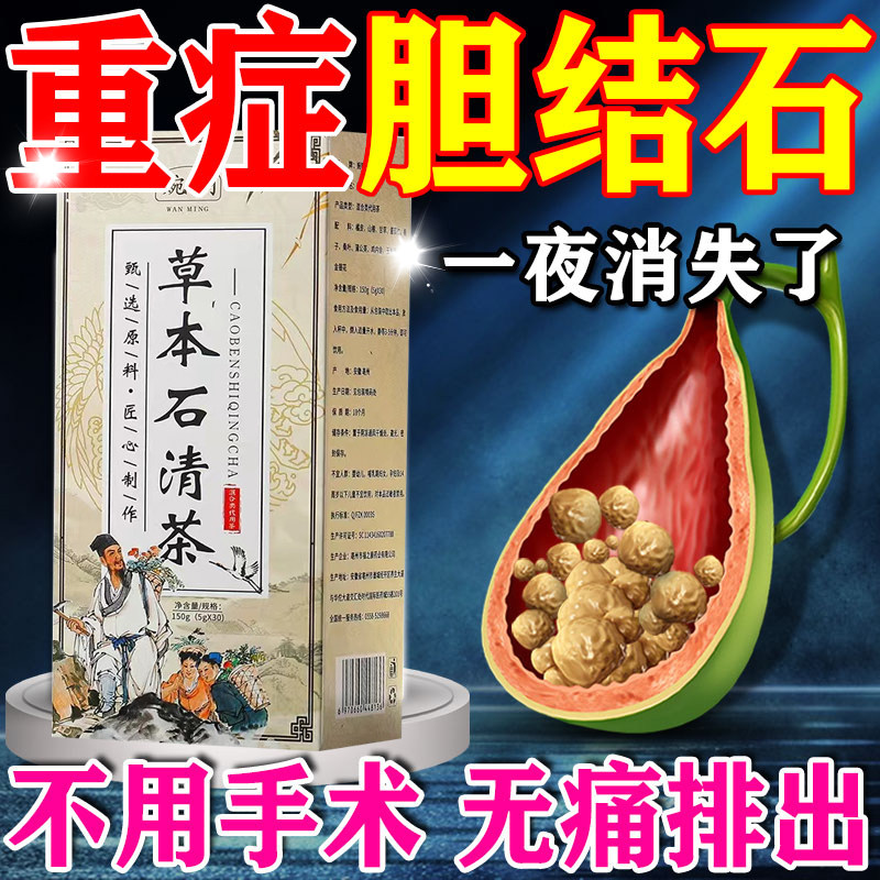 三金排石颗粒治疗多发胆结石溶石化石排石进口药茶金钱草胆囊息肉