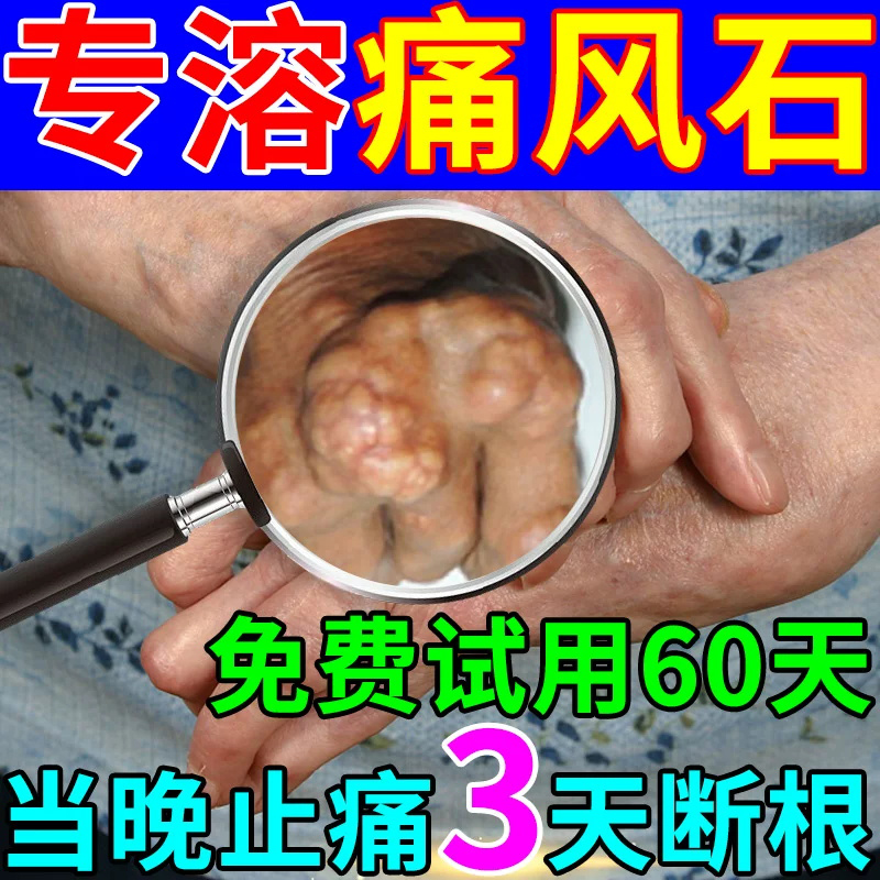 豨桐丸类风湿性关节炎手指变形肿大酸友新版痛风特效药止痛祛风湿