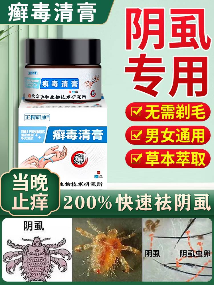 治疗阴虱药女士用私处灭阴虱成人男士一扫光精品去虫瘙痒克星药物