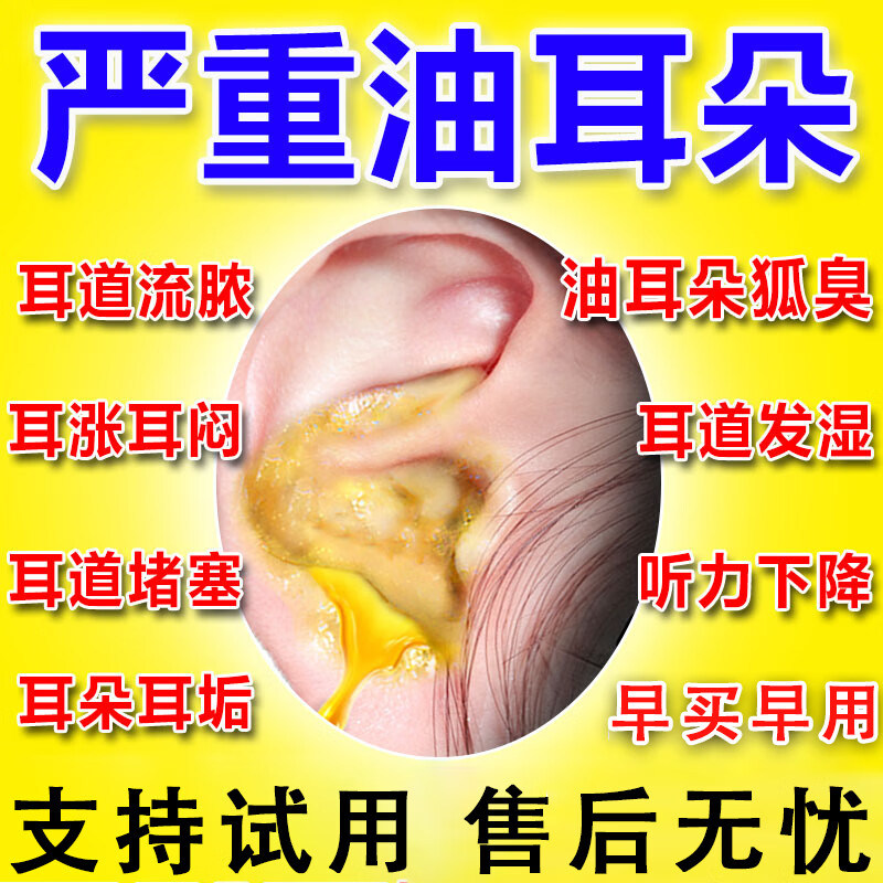 碳酸氢钠抑菌欧诺康滴耳液软化耳屎采耳专用耵聍洗耳儿童耳清洁液图片