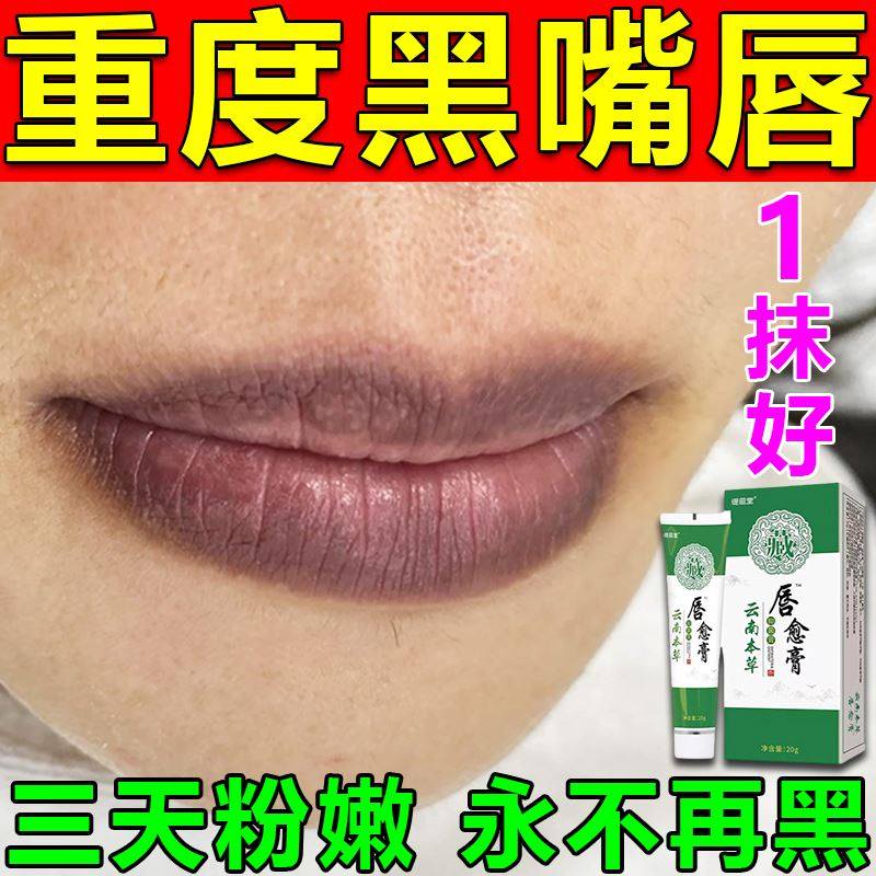 嘴唇发黑发紫去除嘴巴周边暗沉黑色素改善专用膏修复淡化唇部色纹