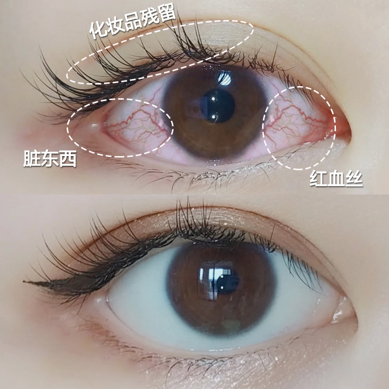春日井山茶花眼睛干涩洗眼液眼睛护理液清洁缓解疲劳告别黄红血丝