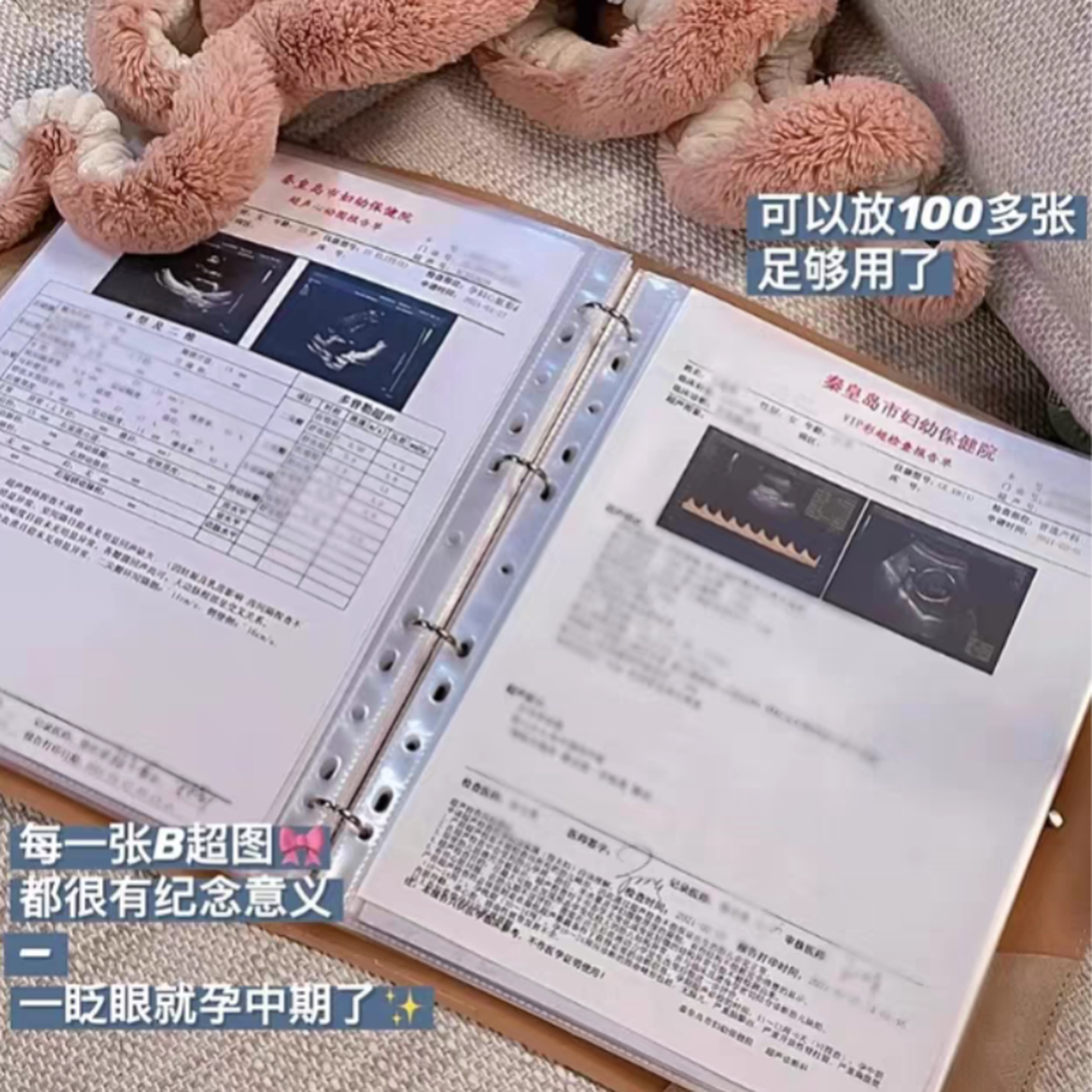 孕妇产检文件袋收纳册孕妈妈b超检查报告单收纳袋体检文件夹便携