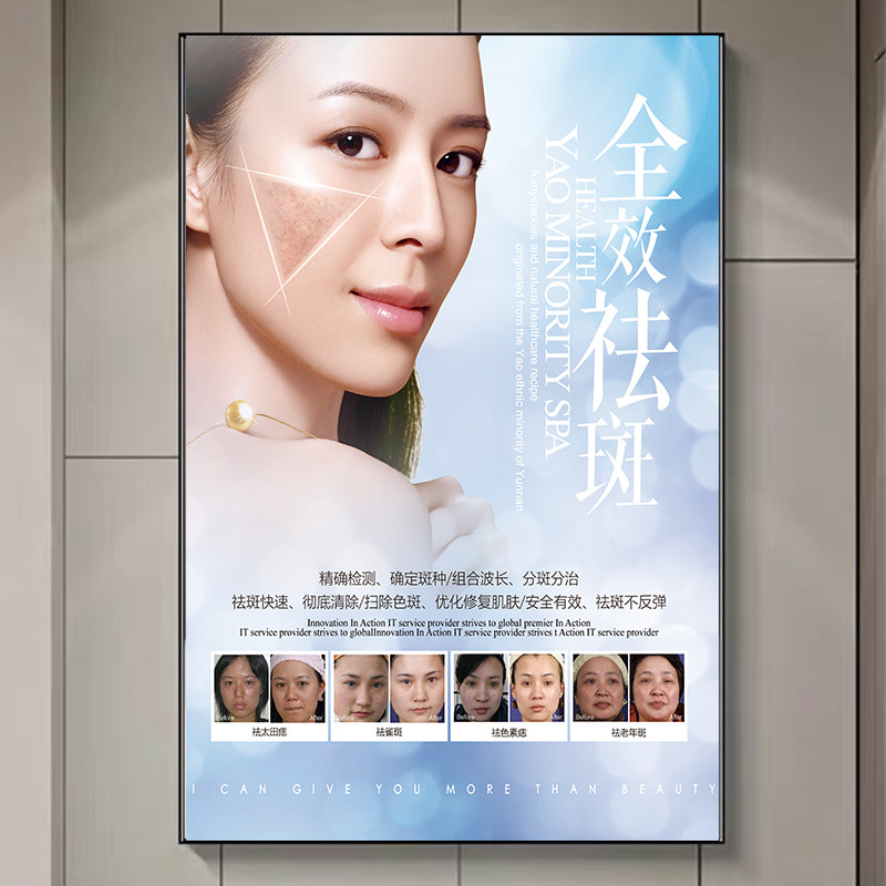 高档院纹绣海报装饰画宣传画360对比图老年晒q斑去斑祛斑海报奢华