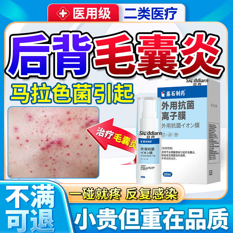 背后长痘痘毛囊炎马拉色菌细菌前胸后背硬疙瘩搭除螨祛痘痒药膏ON