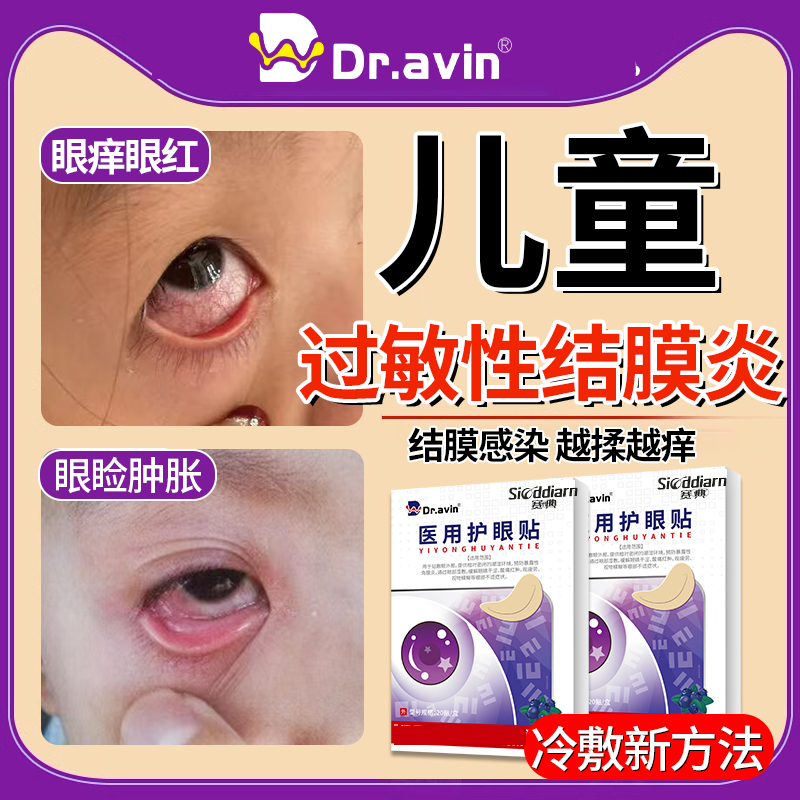 儿童过敏性结膜炎眼贴冷冰敷角膜炎眼睛痒红血丝可搭止痒眼药水ON