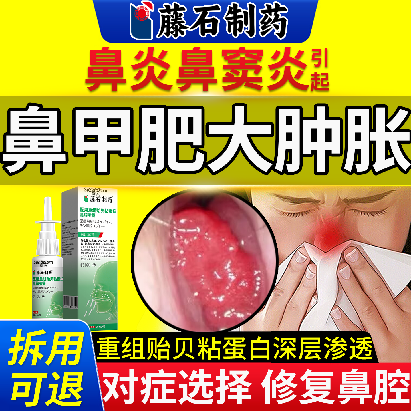 鼻甲肥大肿胀充血鼻炎鼻窦炎专用可搭消炎修复膏药贴鼻息肉脱落YY