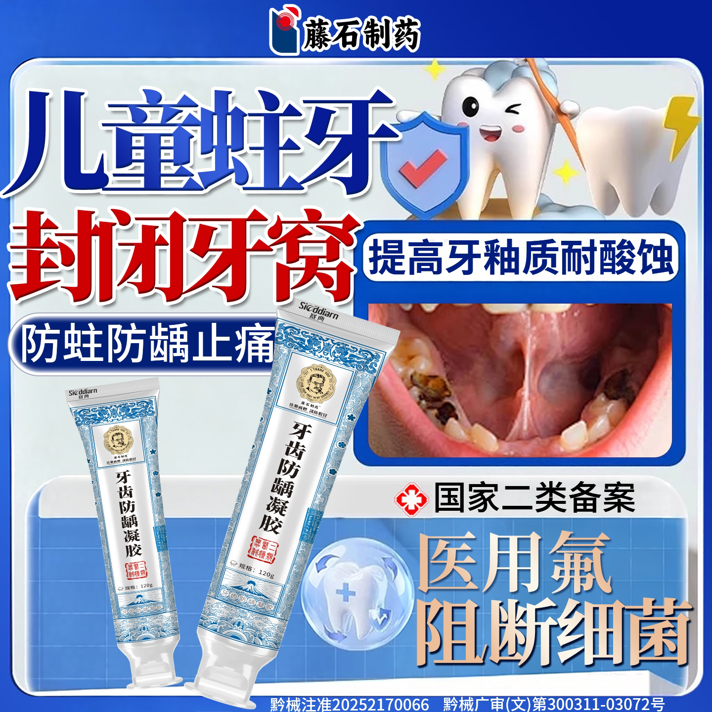 儿童含氟防蛀牙龋齿修复防龋蛀牙虫牙烂牙清理洞可搭牙膏去黑线YY