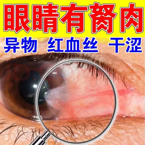 【医用品质】眼睛胬肉专用滴眼液