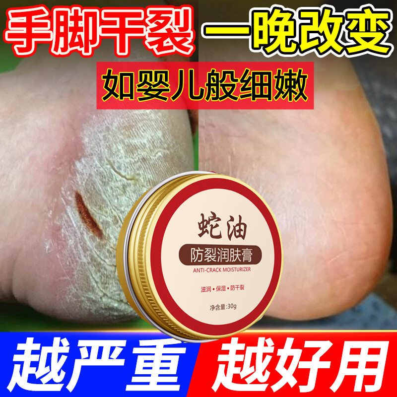 脚后跟干裂修复霜马油手脚部护理防干裂皲裂护手足开皴裂口蛇油膏