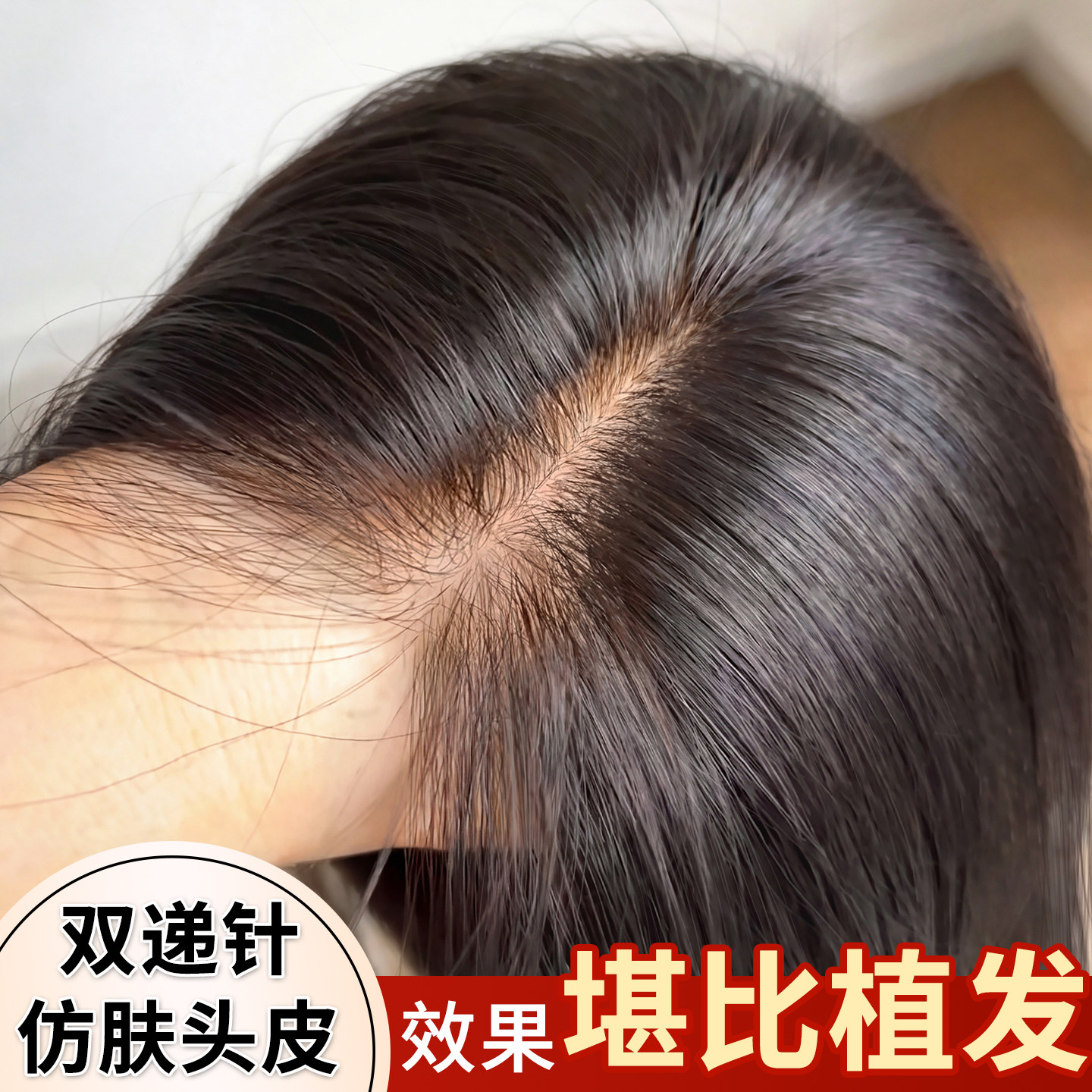 【10*14大面积递针款】头顶补发