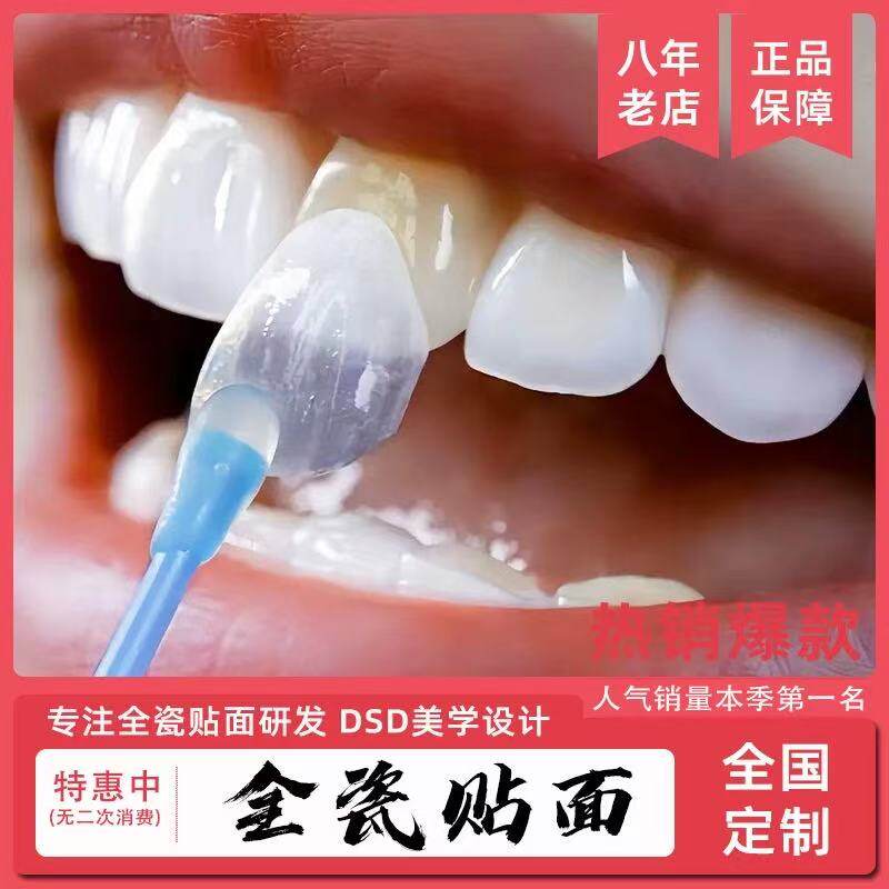 全瓷牙齿贴面美牙工厂牙贴片四环素黄黑牙修复美白水晶瓷琥珀瓷