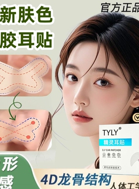 升级新款蝴蝶龙骨精灵耳贴支撑定型过敏招风耳贴面隐形无痛神器