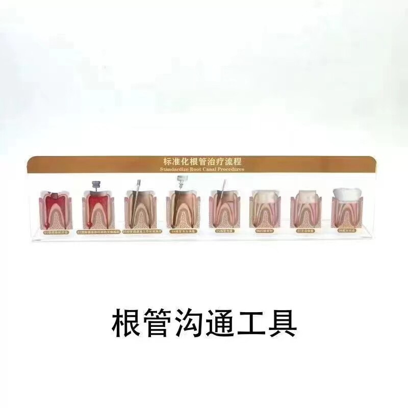 牙科医患沟通工具展板根管治疗亚克力窝沟封闭流程种植牙模型沟通