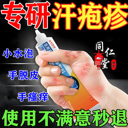 手上起小水泡汗状疱疹止痒湿疹根专用去软膏脱皮真菌感染手气膏药