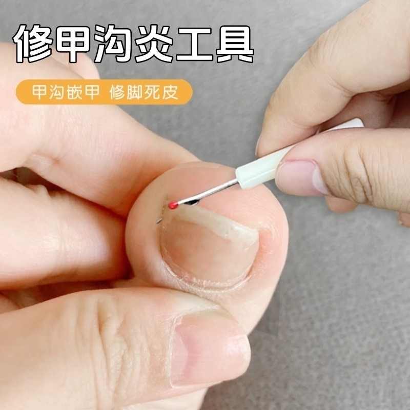 修甲沟炎工具嵌甲专用修剪工具y型修剪推叉剔甲器脚趾缝污垢清理