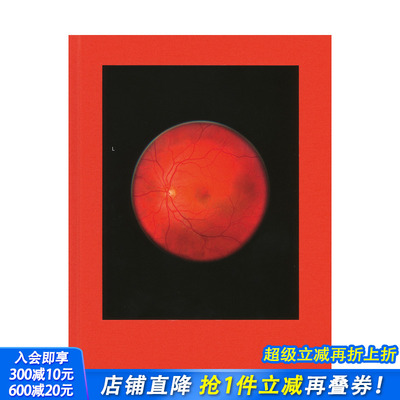 【预售】米哈伊尔·苏博斯基：视网膜转移 Michael Subotzky: Retinal Shift 原版英文摄影 正版进口书