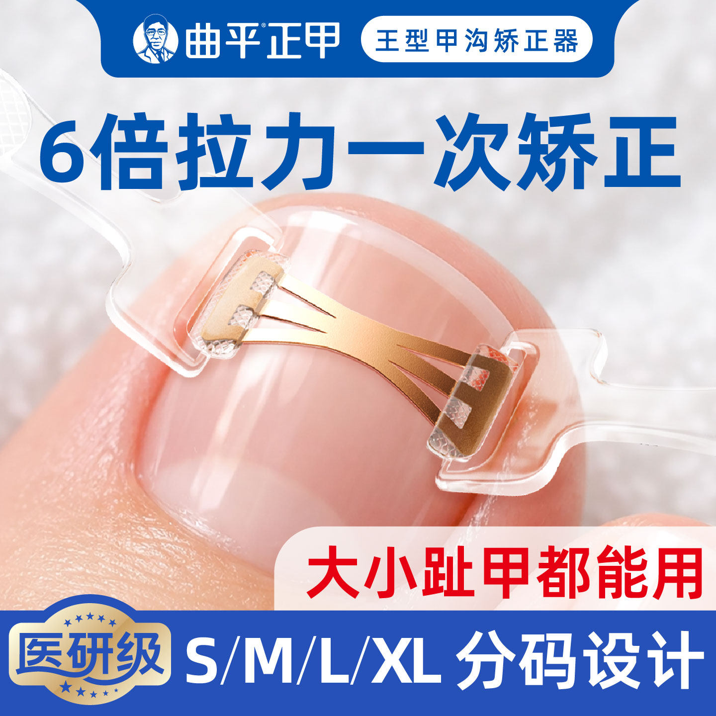 曲平正甲甲沟嵌甲指甲矫正器炎正甲贴片医生脚趾甲盖扎肉足科专用