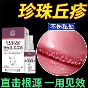 男性龟头炎专用症真菌感染霉菌性喷剂男用私处上有小红点龟炎清