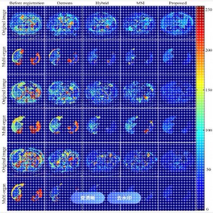 医学图像 医疗影像 图像识别 语义分割 目标检测 深度学习Python