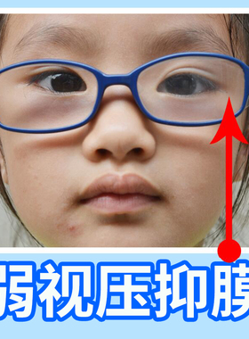 儿童单眼弱视压抑膜半透明全遮盖布隐形眼罩眼贴压贴膜眼镜遮挡贴