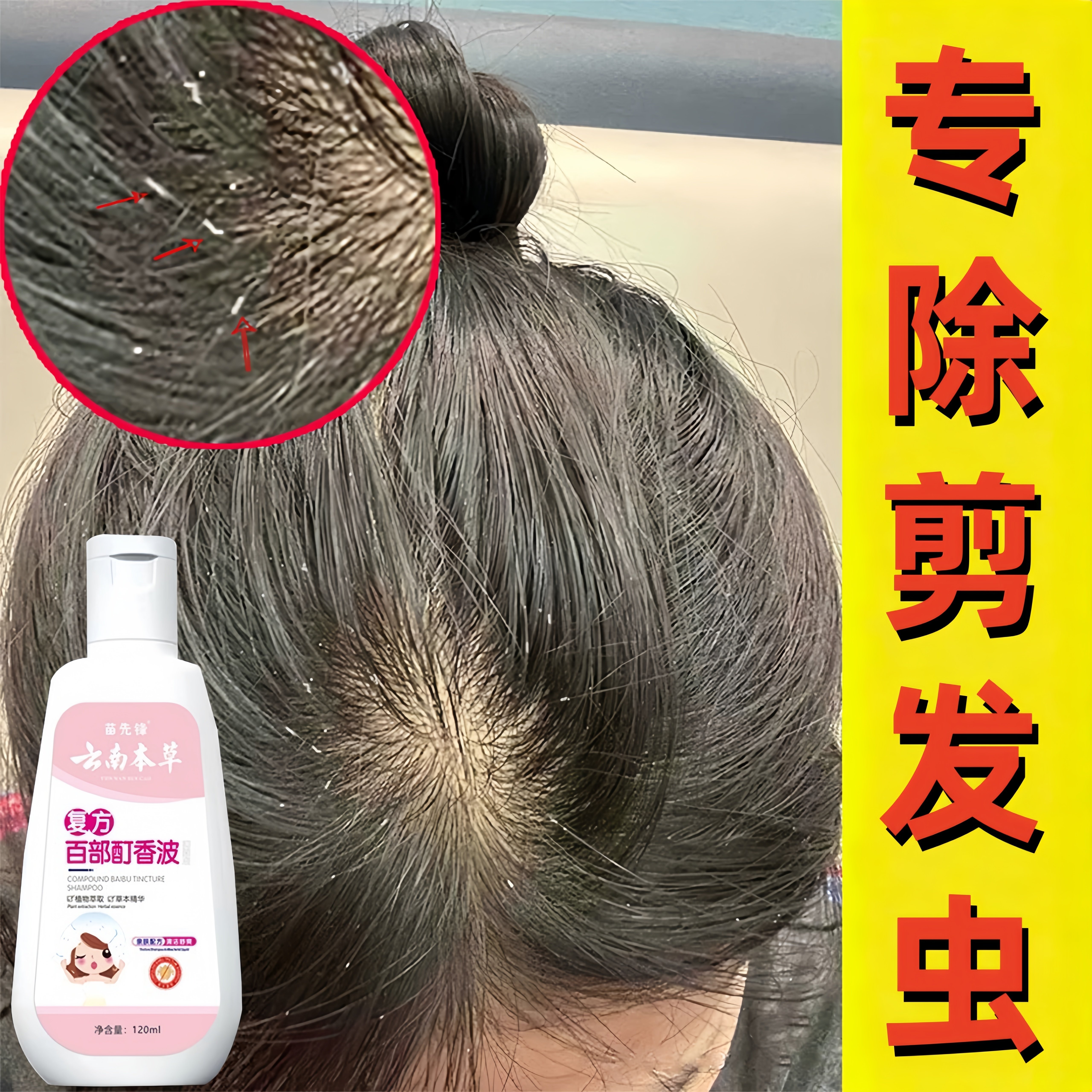 去剪发虫洗发水女童成人除螨虫吃卷发虫头上小白点专用洗发露香波