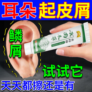 外耳道皮屑软膏霉菌性耳道炎真菌感染干燥起皮耳朵流脓发炎专用药