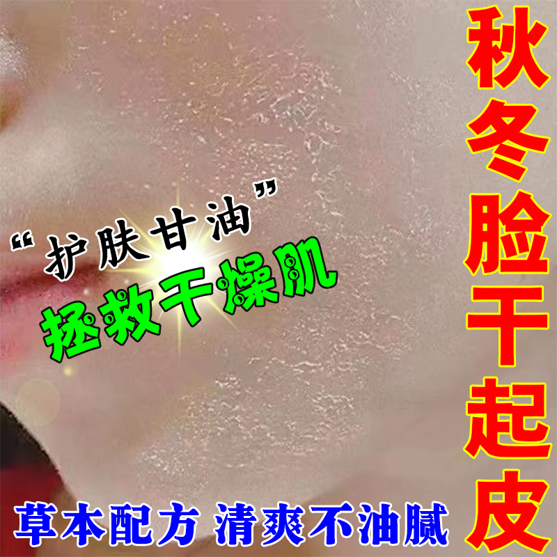 药膏脸干燥脸干起皮皮肤干燥红痒