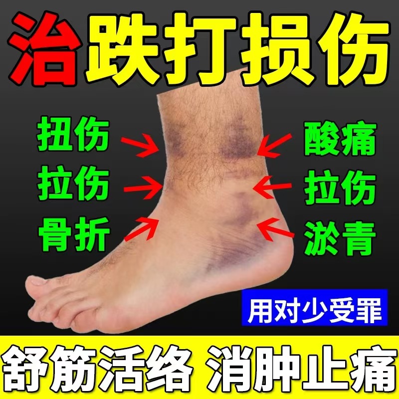 跌打损伤去瘀膏药舒筋消肿止痛伤筋动骨膏骨裂关节疼痛活络油正品