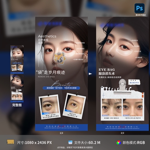 医美祛眼袋抗衰案例对比海报人物眼睛眼周美容美业PSD模板素材