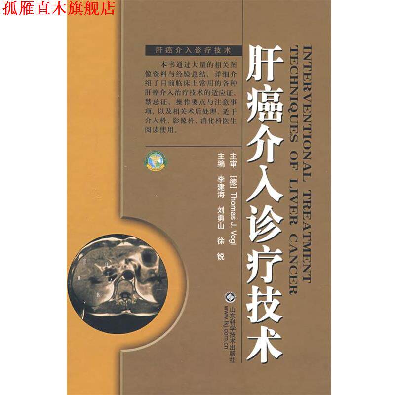 【正版书】 肝癌介入诊疗技术 (德)沃格,李建海,刘勇山　主编 山东科学技术出版社